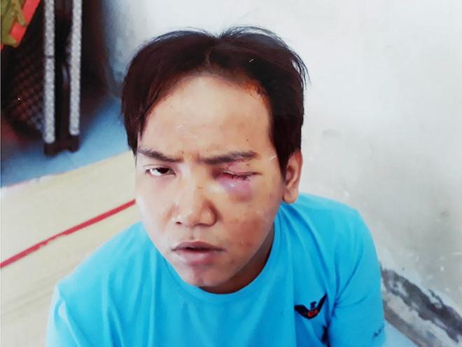 Hé lộ nguyên nhân bảo vệ dân phố sát hại bé trai 6 tuổi-1