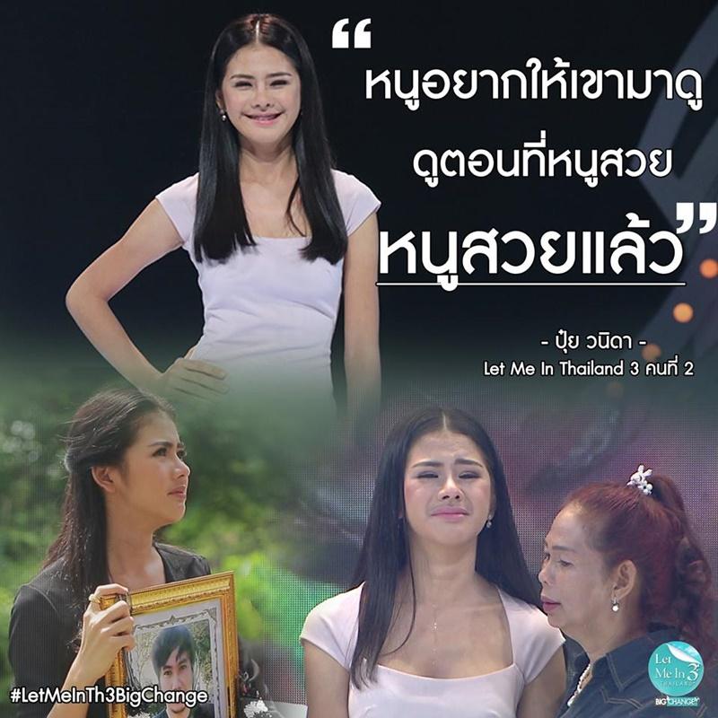 Bị miệt thị xấu như phù thủy, cô gái bán hàng rong thành thiên nga sau thẩm mỹ-4