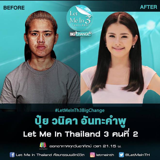 Bị miệt thị xấu như phù thủy, cô gái bán hàng rong thành thiên nga sau thẩm mỹ-1