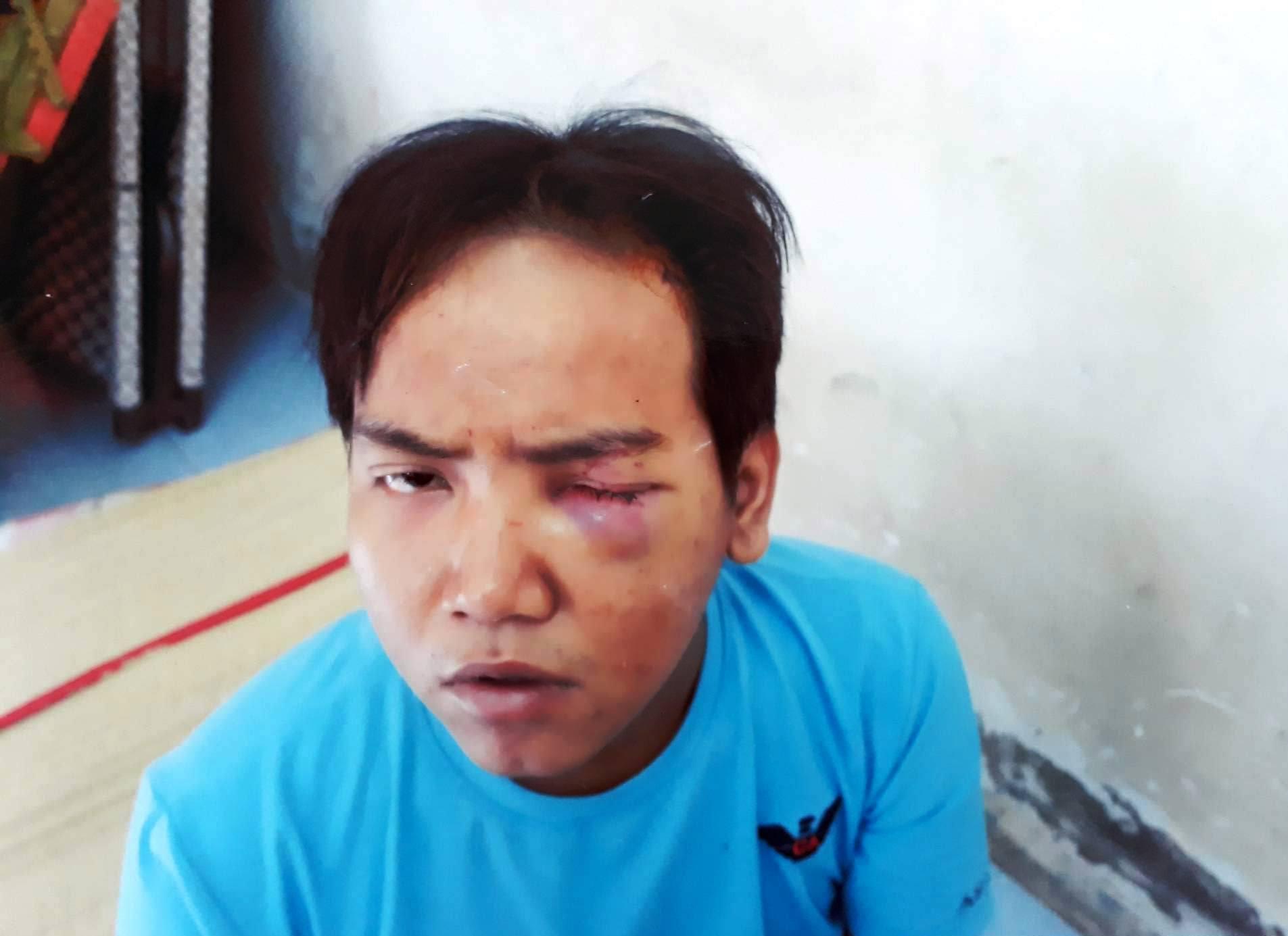 Vụ bảo vệ dân phố sát hại bé 6 tuổi: Lãnh đạo Công an TP HCM nói gì?-1