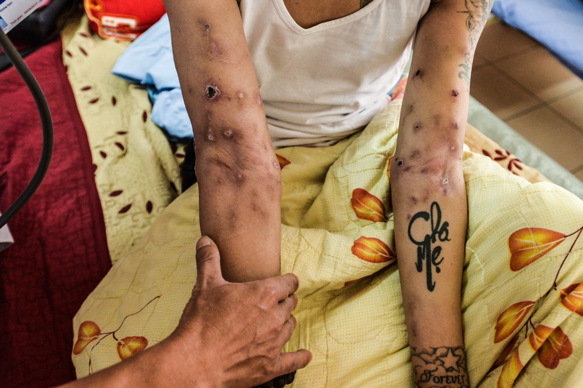 Những bệnh nhân quanh năm không người đến thăm-11