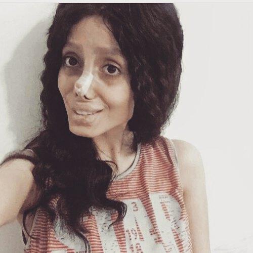 Cô gái hóa quỷ dạ xoa sau 50 lần phẫu thuật thẩm mỹ để giống thần tượng Angelina Jolie-4