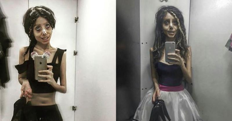 Cô gái hóa quỷ dạ xoa sau 50 lần phẫu thuật thẩm mỹ để giống thần tượng Angelina Jolie-6