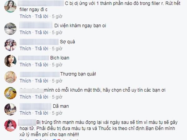 Tiêm filler nâng mũi tưởng ngon ăn, cô gái khóc thét khi biết mũi có thể hoại tử vì tiêm trúng tĩnh mạch-2
