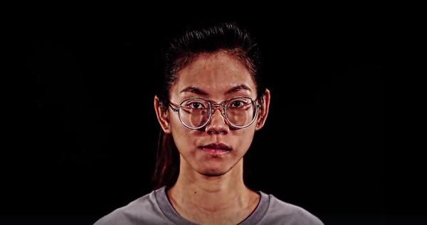 Cô gái hàm lệch, miệng méo thay đổi ấn tượng sau thẩm mỹ khiến mẹ đẻ khóc nghẹn vì xúc động-1