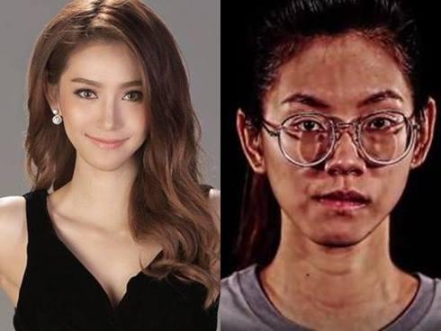 Sở hữu răng hô, chân cong cô gái này hóa mỹ nhân chỉ nhờ một cuộc phẫu thuật-7