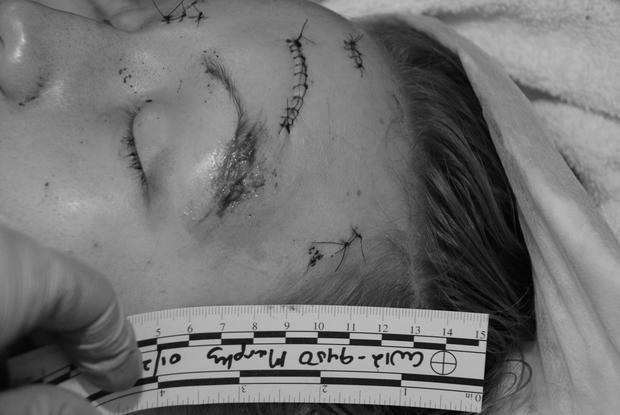 Cho bạn trai ôm lần cuối trước khi chia tay, cô gái xinh xắn đau đớn lãnh 32 nhát dao-6