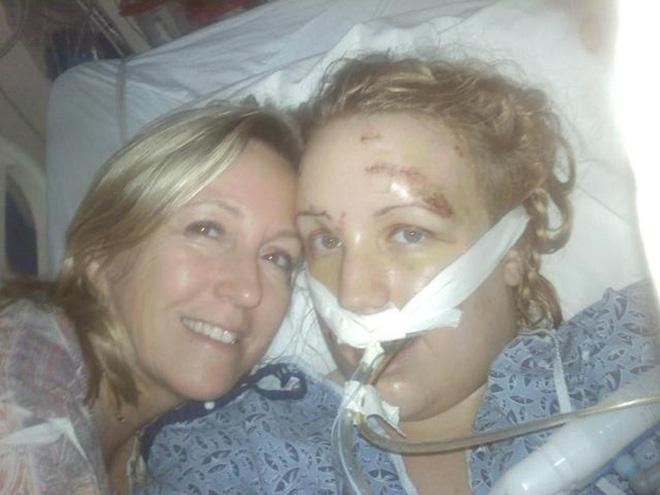 Cho bạn trai ôm lần cuối trước khi chia tay, cô gái xinh xắn đau đớn lãnh 32 nhát dao-7