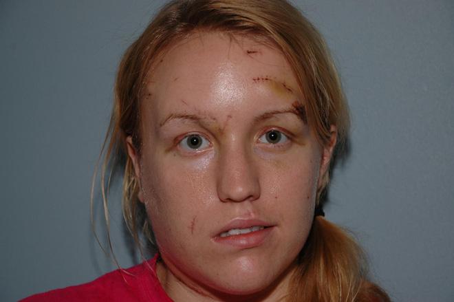 Cho bạn trai ôm lần cuối trước khi chia tay, cô gái xinh xắn đau đớn lãnh 32 nhát dao-8