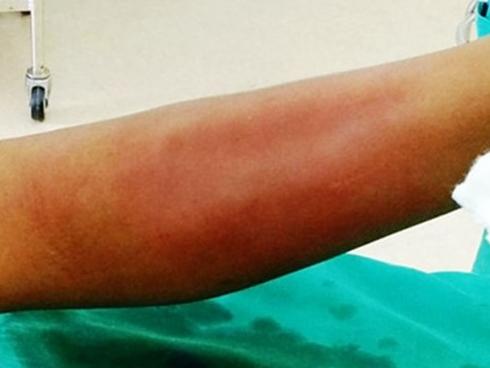 Hoảng hồn chiêu chữa bệnh rút lưỡi chảy máu của công chúa thuốc lào-2