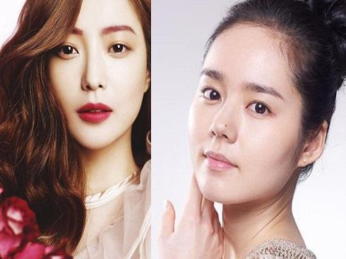 Sao Hàn sở hữu nốt ruồi trên mũi: Sự nghiệp thành công, đời tư hạnh phúc