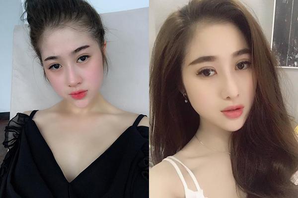 Đã sẵn xinh đẹp, cô gái này vẫn chi 400 triệu phẫu thuật thẩm mỹ để được lộng lẫy hơn-1