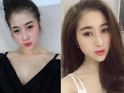 Đã sẵn xinh đẹp, cô gái này vẫn chi 400 triệu phẫu thuật thẩm mỹ để được lộng lẫy hơn