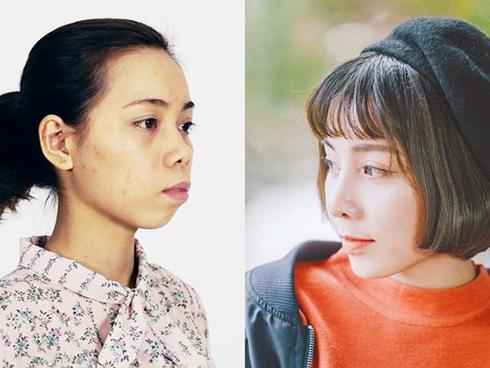 Phẫu thuật 30 lần để vừa lòng bạn trai, cô gái 22 tuổi hối hận vì quyết định dao kéo-7