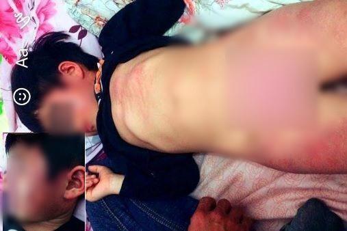 Bắc Giang: Kết luận chính thức vụ bé gái 4 tuổi bị đánh bầm tím tại trường mầm non-1