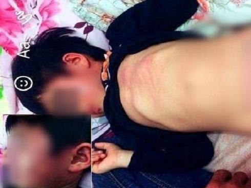 Bắc Giang: Kết luận chính thức vụ bé gái 4 tuổi bị đánh bầm tím tại trường mầm non