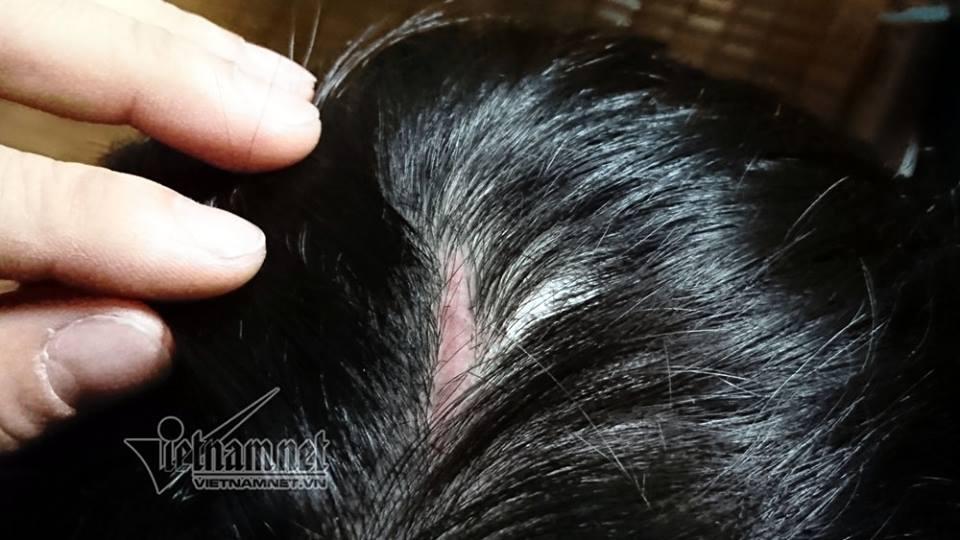 Bé trai bị bố và mẹ kế đánh rạn sọ não xin tha cho bố-2