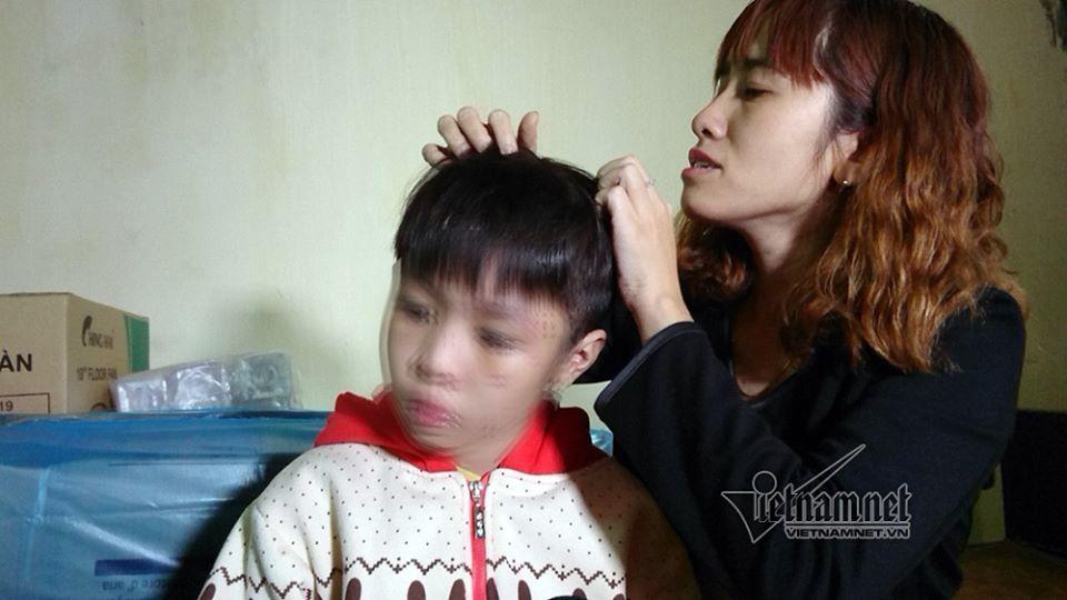 Bé trai bị bố và mẹ kế đánh rạn sọ não xin tha cho bố-3