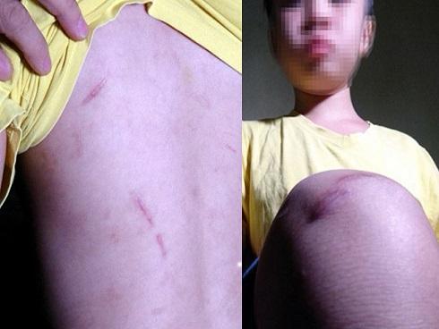 Lời khai của người bố cùng mẹ kế đánh đập con trai 10 tuổi rạn sọ não: Do con nghịch ngợm lâu ngày-3