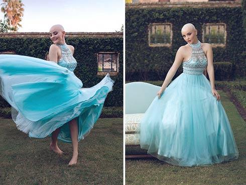 Cô gái 17 tuổi xinh như búp bê cắt trụi tóc để chụp ảnh, biết được sự thật ai cũng nể phục