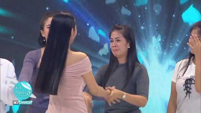 Sở hữu răng hô, chân cong cô gái này hóa mỹ nhân chỉ nhờ một cuộc phẫu thuật-5