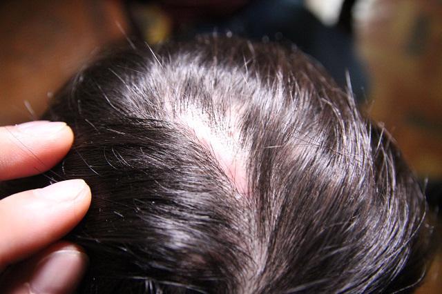 Những vết thương trên cơ thể bé trai 10 tuổi bị bạo hành ai nhìn thấy cũng xót xa-11