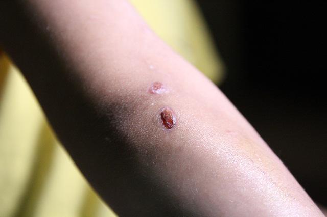 Những vết thương trên cơ thể bé trai 10 tuổi bị bạo hành ai nhìn thấy cũng xót xa-7