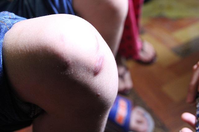 Những vết thương trên cơ thể bé trai 10 tuổi bị bạo hành ai nhìn thấy cũng xót xa-8