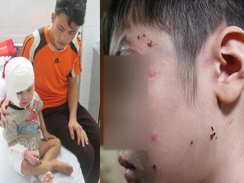 Bức thư đau lòng của cậu bé bị mẹ đẻ bạo hành dã man, phải ăn thức ăn của chó-4