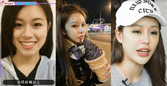 Phẫu thuật 30 lần để vừa lòng bạn trai, cô gái 22 tuổi hối hận vì quyết định dao kéo-1