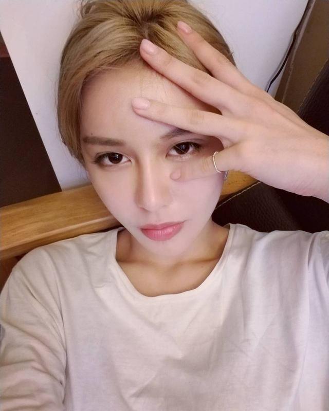 Phẫu thuật 30 lần để vừa lòng bạn trai, cô gái 22 tuổi hối hận vì quyết định dao kéo-4