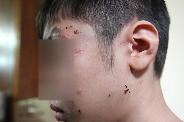 Chi tiết lời khai của người mẹ kế vụ bé trai 10 tuổi bị bạo hành ở Hà Nội-1