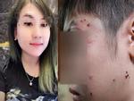 Chi tiết lời khai của người mẹ kế vụ bé trai 10 tuổi bị bạo hành ở Hà Nội