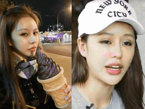 Phẫu thuật 30 lần để vừa lòng bạn trai, cô gái 22 tuổi hối hận vì quyết định 'dao kéo'