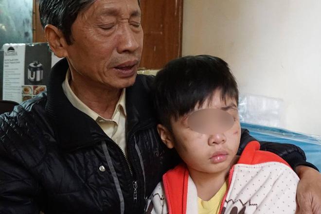 Lãnh đạo trường học của bé bị bạo hành: Hôm khai giảng không thấy bé đi học nên có gọi điện hỏi thăm-2