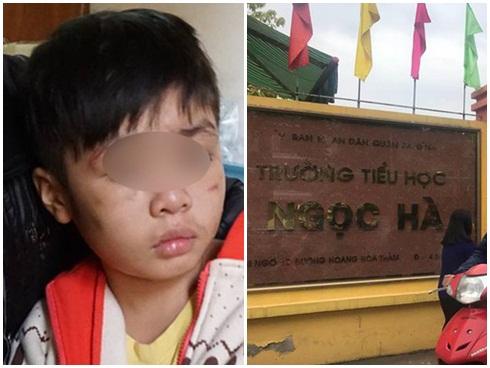 Rơi nước mắt với những đứa trẻ bị bố và mẹ kế bạo hành dã man-7