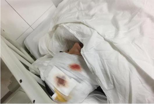 Nam diễn viên Thiên sơn mộ tuyết đang hôn mê vì gặp tai nạn nghiêm trọng-5