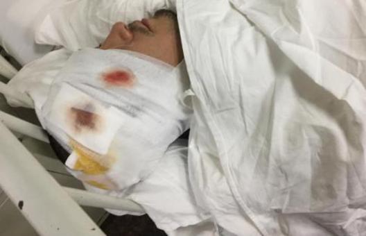 Nam diễn viên Thiên sơn mộ tuyết đang hôn mê vì gặp tai nạn nghiêm trọng-6