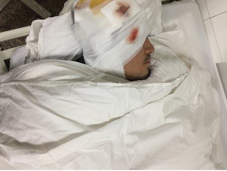 Nam diễn viên Thiên sơn mộ tuyết đang hôn mê vì gặp tai nạn nghiêm trọng-7