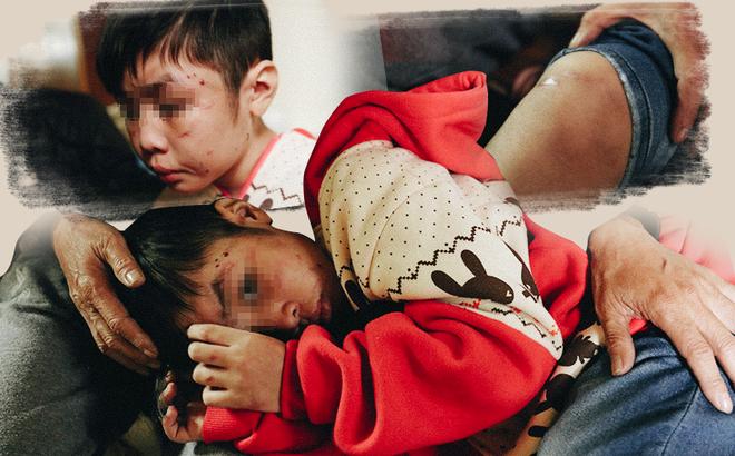 Rơi nước mắt với những đứa trẻ bị bố và mẹ kế bạo hành dã man-1