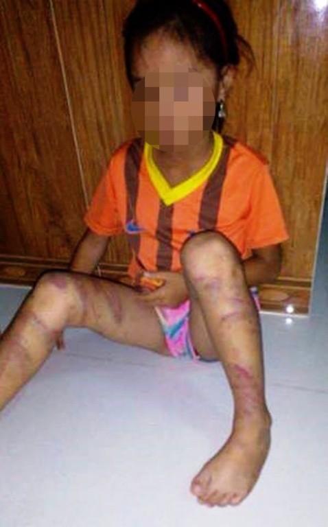 Rơi nước mắt với những đứa trẻ bị bố và mẹ kế bạo hành dã man-3