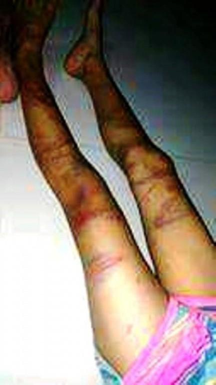 Rơi nước mắt với những đứa trẻ bị bố và mẹ kế bạo hành dã man-4