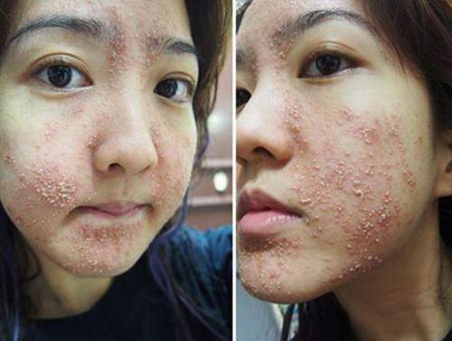 Tất tần tật công dụng làm đẹp của dầu dừa và tác hại khôn lường nếu dùng sai cách-4