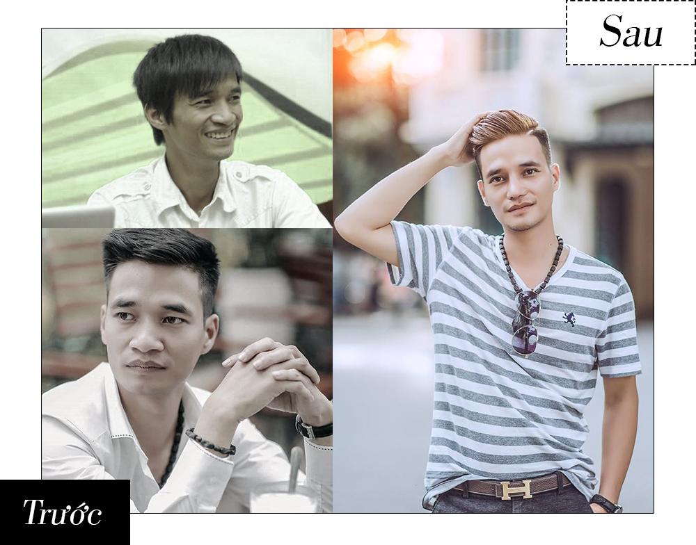 Những ca phẫu thuật thẩm mỹ gây chấn động dư luận trong năm 2017-4