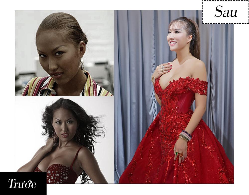 Những ca phẫu thuật thẩm mỹ gây chấn động dư luận trong năm 2017-2