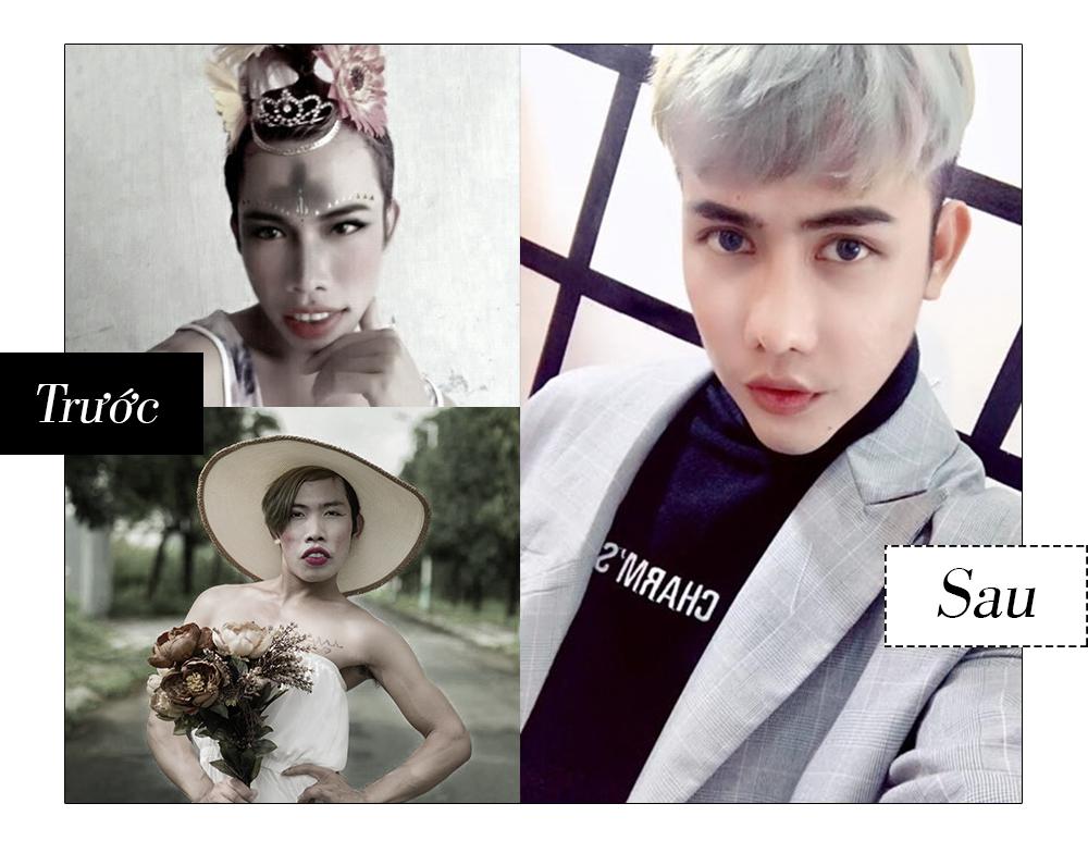 Những ca phẫu thuật thẩm mỹ gây chấn động dư luận trong năm 2017-5