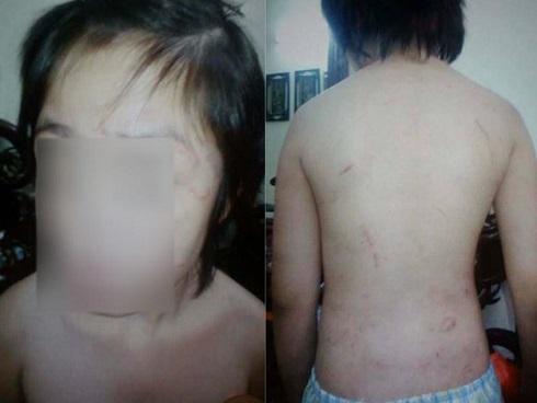 Bố đẻ, mẹ kế bạo hành bé trai 10 tuổi: Mái tóc đứa trẻ lâu không cắt và sự lạnh ngắt yêu thương