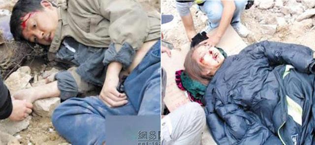 Tai nạn phim trường của sao Hoa ngữ: Người phẫu thuật toàn thân, kẻ vĩnh viễn mất mạng-6