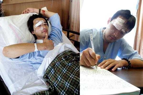 Tai nạn phim trường của sao Hoa ngữ: Người phẫu thuật toàn thân, kẻ vĩnh viễn mất mạng-9