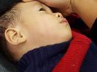 Hà Nội: Bé trai 23 tháng tuổi đi khám viêm mũi bị bác sĩ tát hằn bàn tay lên má